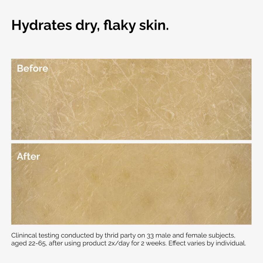 the-body-care-collection-i7 ord-natural-moisturizing-factors-inulin-body-before-after-graphic-02.jpg