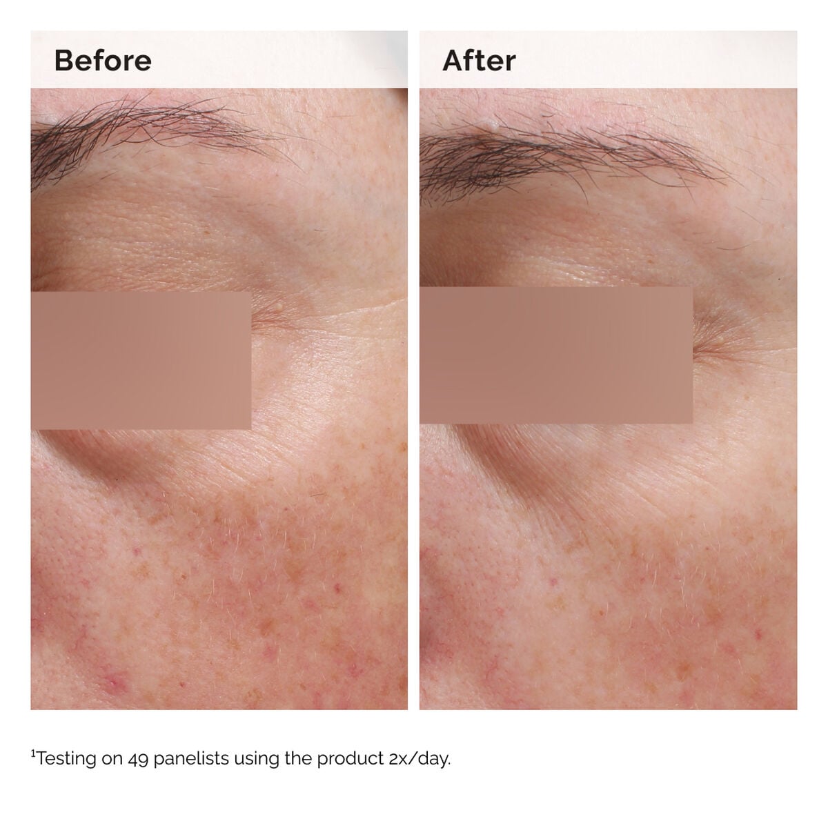 niacinamide-5-face-and-body-emulsion-n9 2024-08-23-ORD-Nia-5pct-Face-Body-B-A-Elasticity-Global-02-1x1.jpg