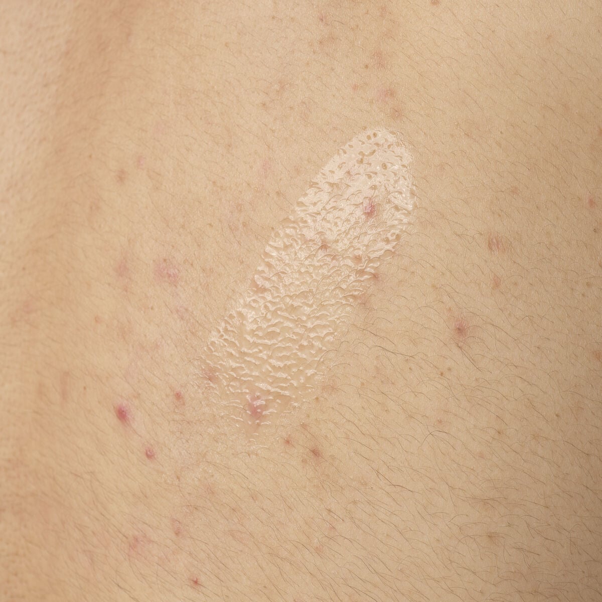 salicylic-acid-0-5-body-serum-t7 ORD-salicylic-acid-05-body-240ml-application.jpg
