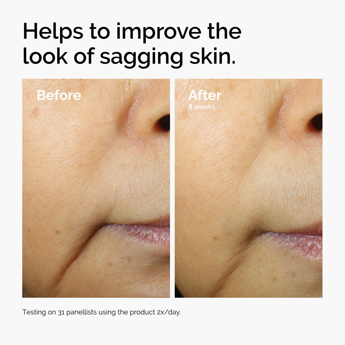caffeine-3-escin-1-face-serum-o4 ord-caffeine-3pct-escin-1pct-face-serum-before-after-sagging.jpg