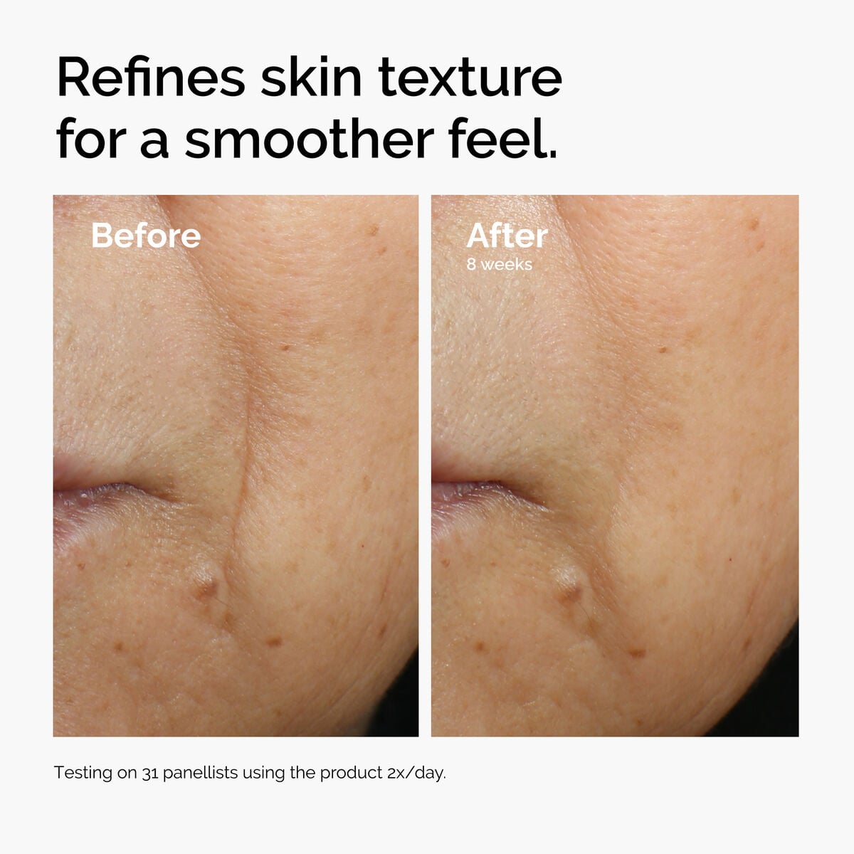 caffeine-3-escin-1-face-serum-o4 ord-caffeine-3pct-escin-1pct-face-serum-before-after-texture.jpg