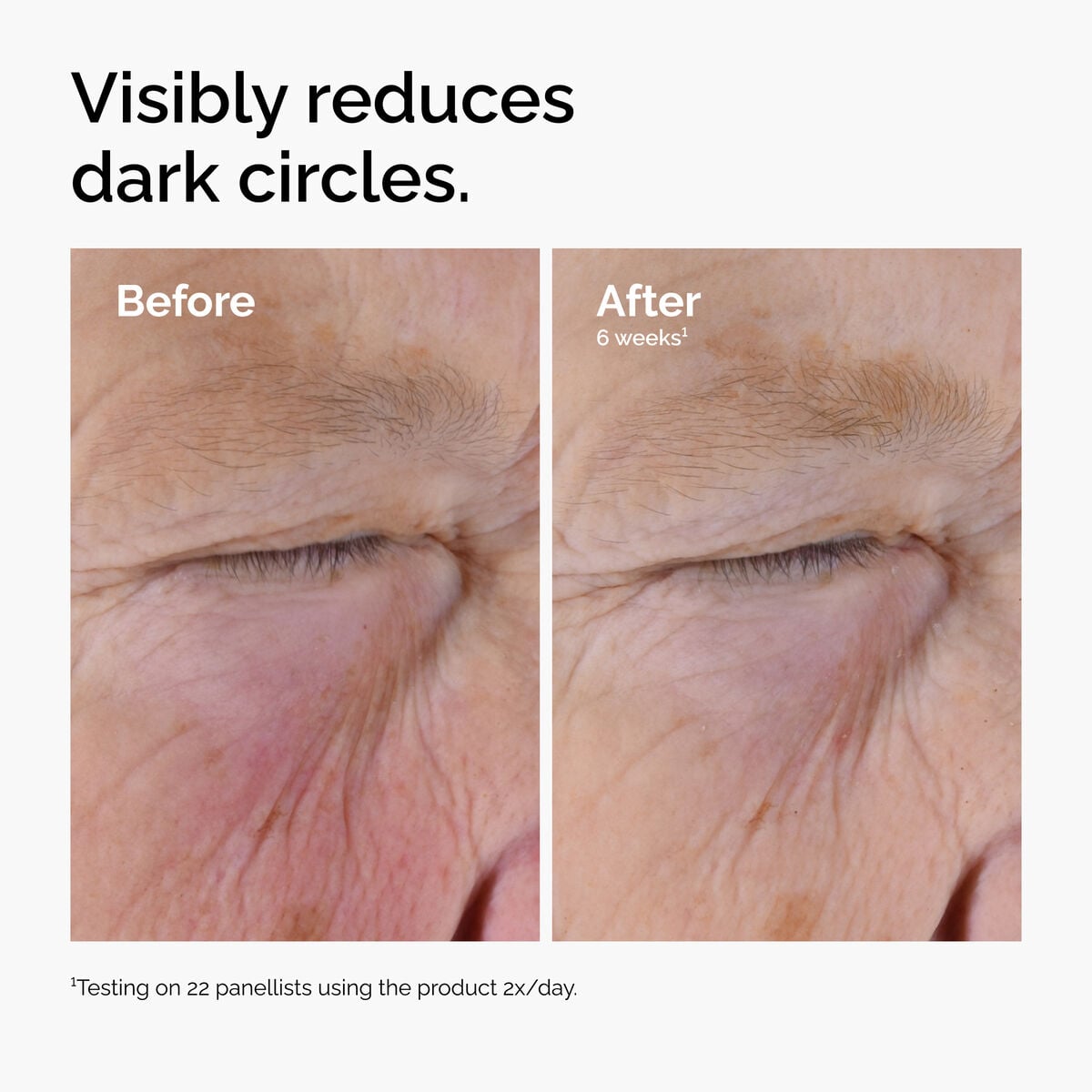 caffeine-solution-5-egcg-eye-serum-k2 ord-caffeine-solution-egcg-dark-circles-before-after.jpg