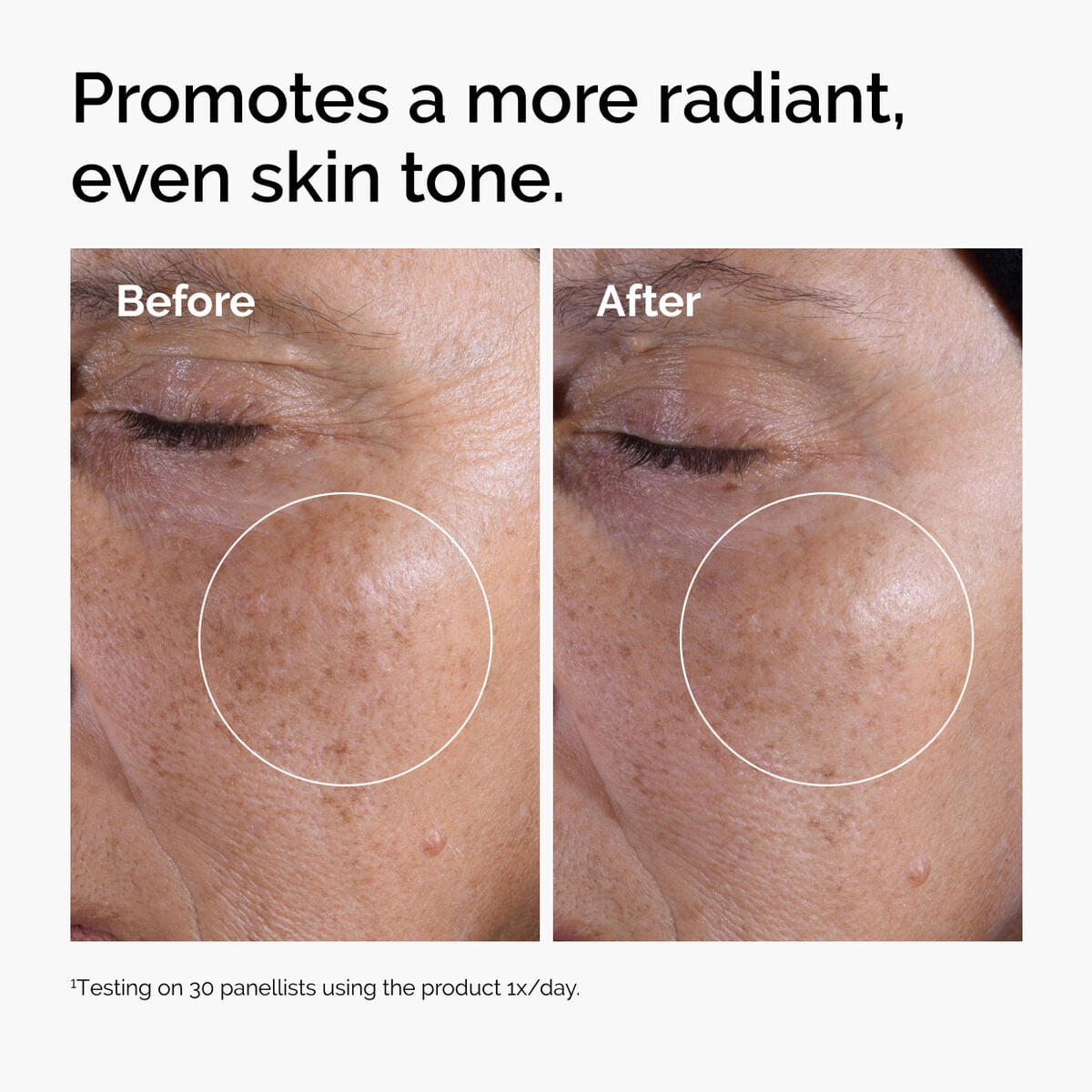 glycolic-acid-7-exfoliating-toner-f7 ord-glycolic-before-after-radiance.jpg