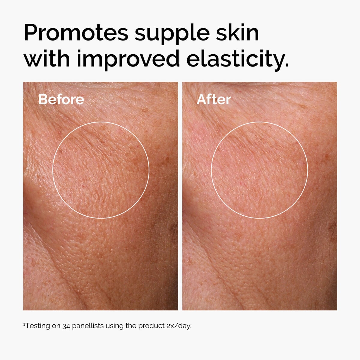 hyaluronic-acid-2-b5-with-ceramides-i9 ord-hyaluronic-acid-2pct-b5-hydrating-serum-before-after-elasticity.jpg
