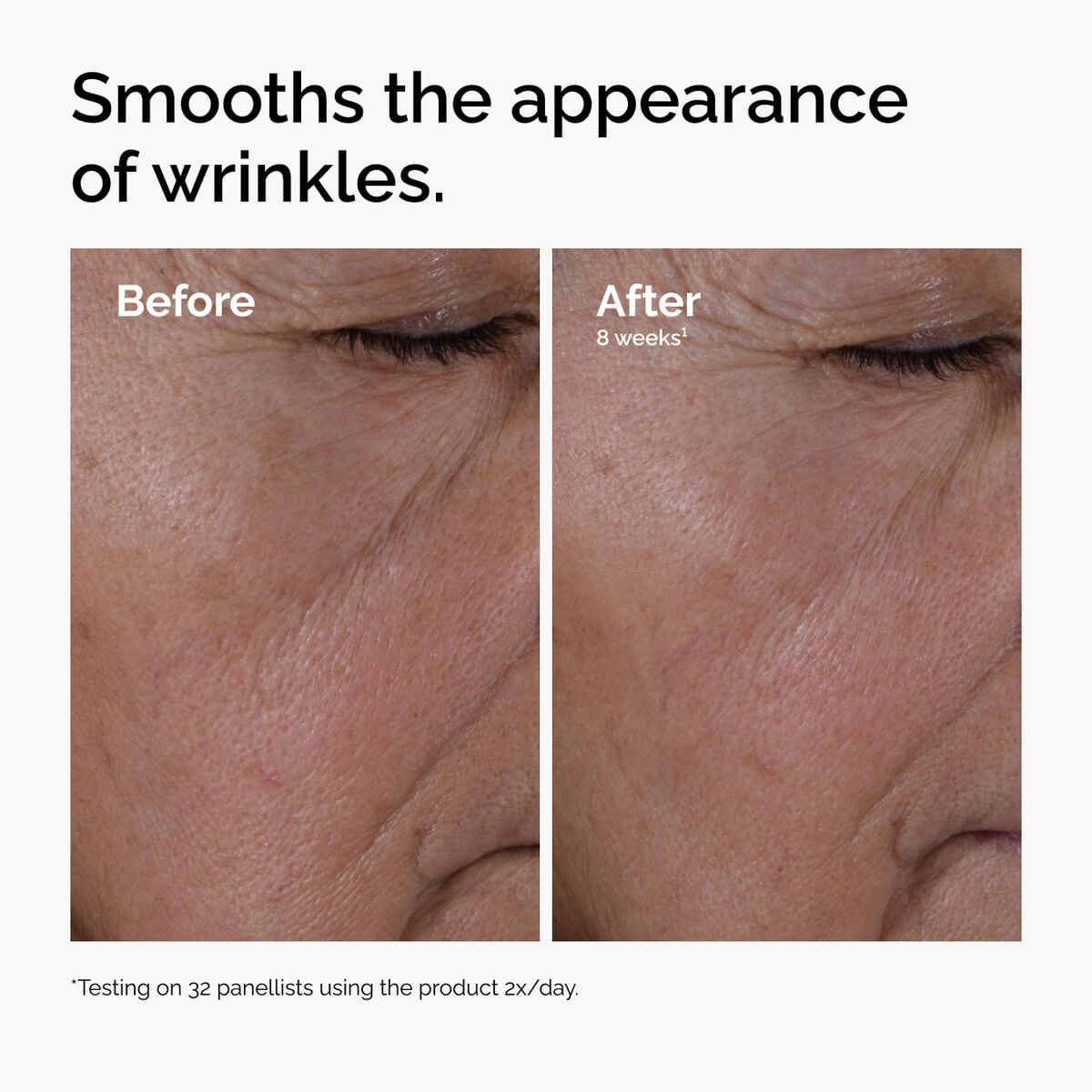 multi-peptide-ha-serum-g7 ord-multi-peptide-ha-serum-wrinkles-before-after.jpg