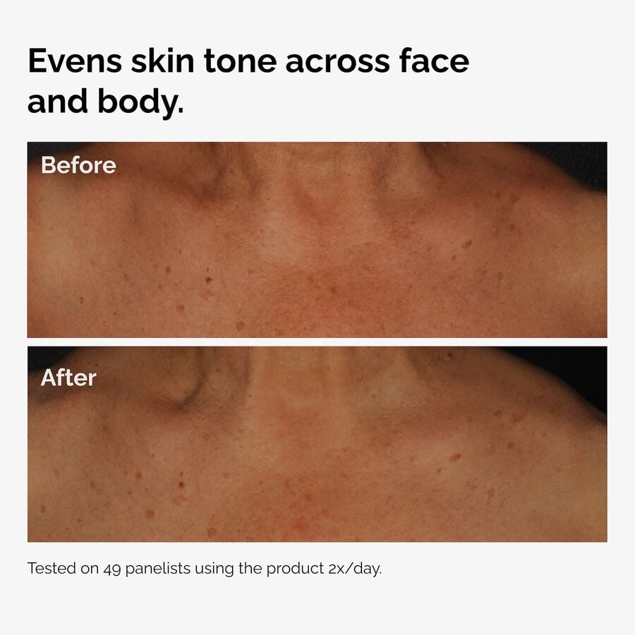 the-body-care-collection-i7 ord-niacinamide-face-body-serum-before-after-even-tone-graphic.jpg