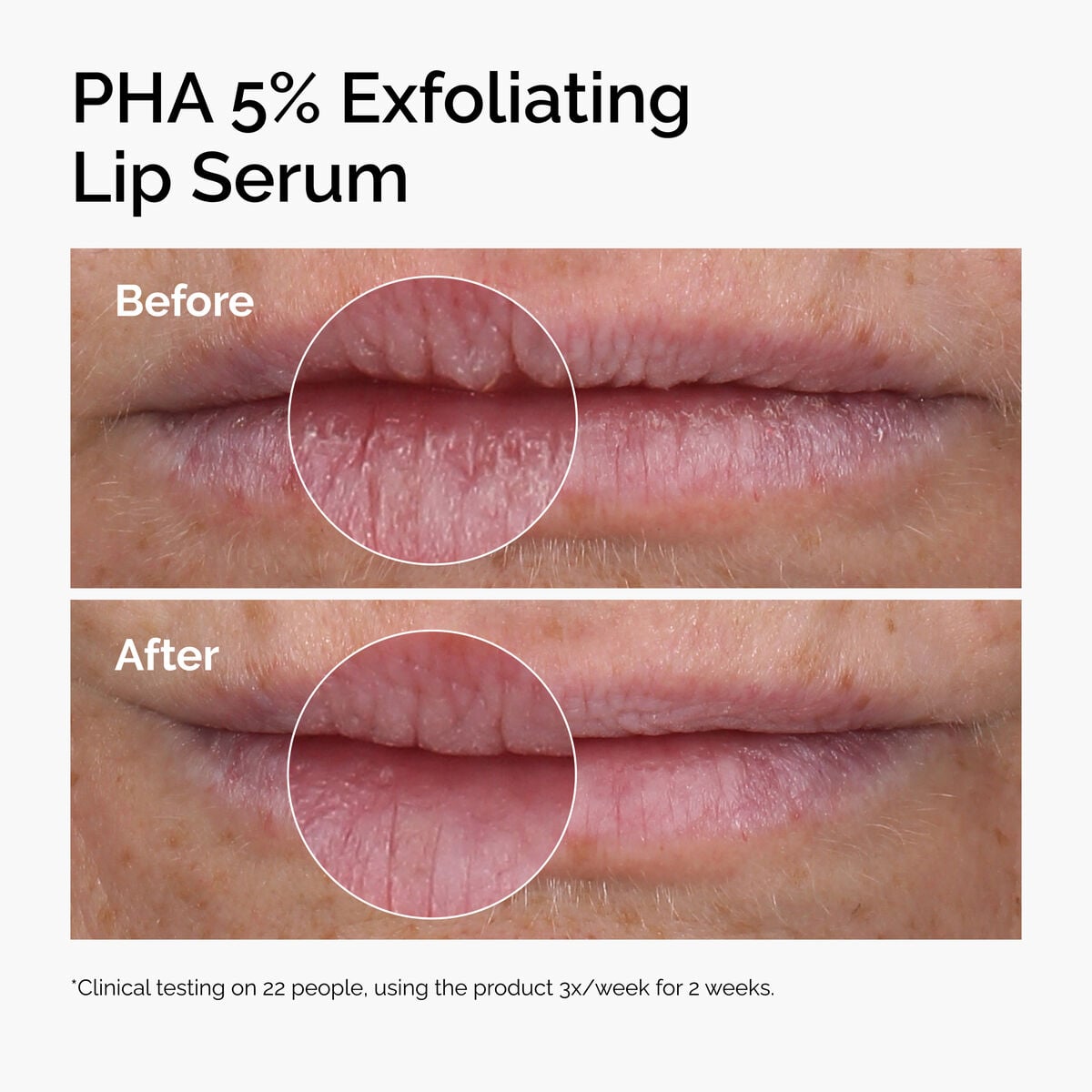 pha-5-exfoliating-lip-serum-r1 ord-pha-5pct-lip-exfoliating-serum-before-after.jpg