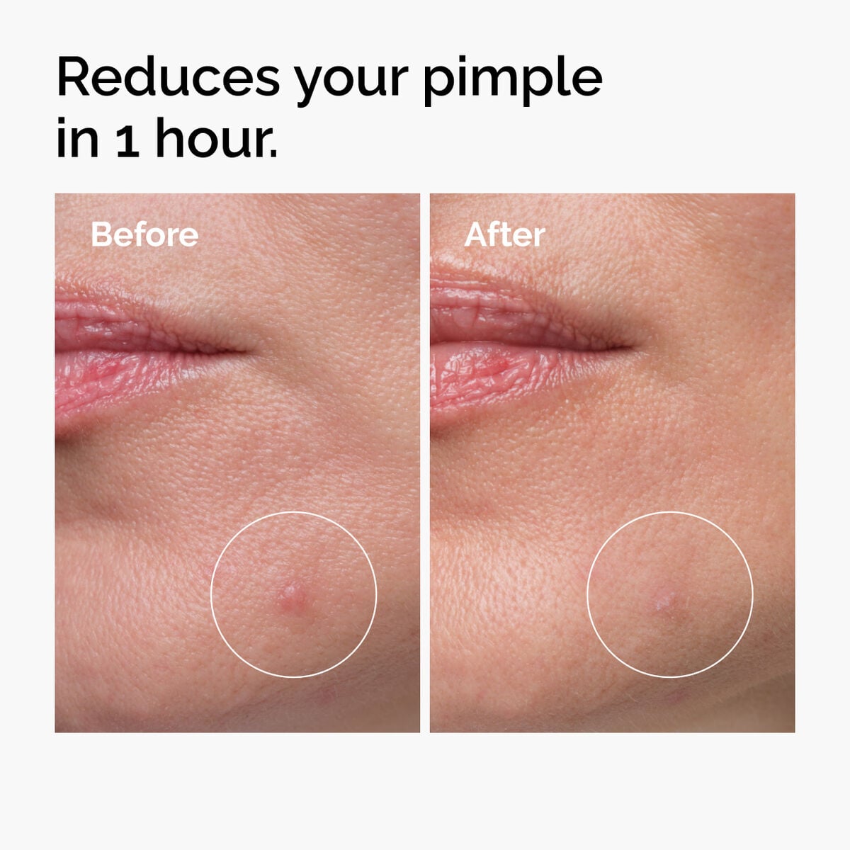 sulfur-10-powder-to-cream-concentrate-p6 ord-sulfur-10pct-powder-to-cream-concentrate-before-after-NA.jpg